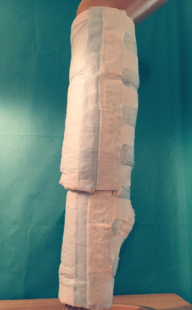 First prototype on leg