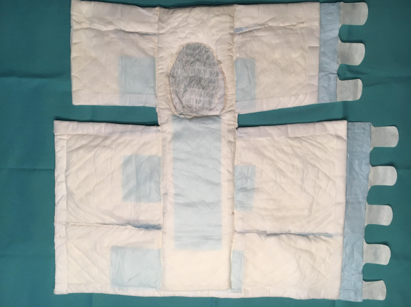 First prototype opened
